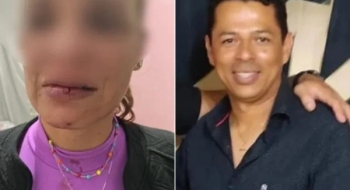 Secretário de Comunicação da Prefeitura de Morrinhos é preso suspeito de dar soco no rosto da esposa